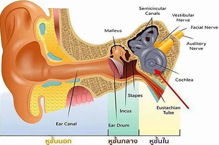 น้ำในหู, สาเหตุน้ำในหูไม่เท่ากัน